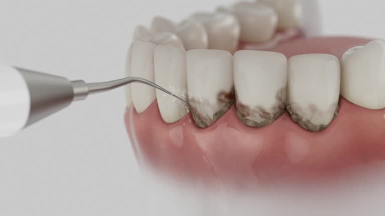 Reliable Teeth Whitening contractor in McKenzie County County, ND by Dentist Open Now